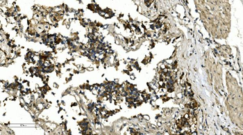 HDAC4 Rabbit Polyclonal Antibody