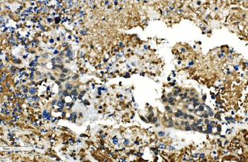 HDAC4 Rabbit Polyclonal Antibody