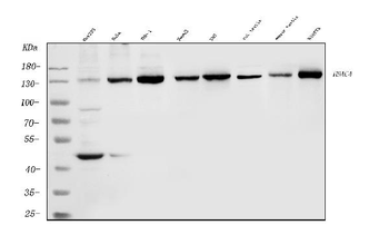 HDAC4 Rabbit Polyclonal Antibody