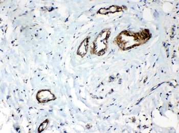 HSPB8/Hsp22 Antibody
