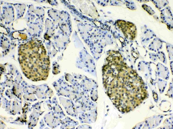 HSPB8/Hsp22 Antibody