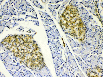 HSPB8/Hsp22 Antibody