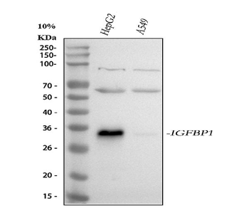 IGFBP1 Rabbit Polyclonal Antibody
