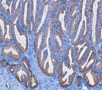 Cytokeratin 8/KRT8 Antibody