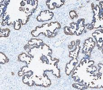 Cytokeratin 8/KRT8 Antibody
