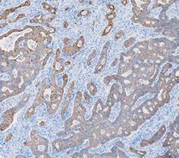 Cytokeratin 8/KRT8 Antibody