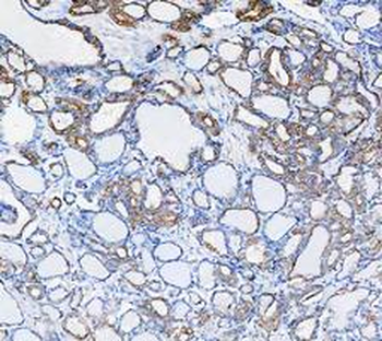 Cytokeratin 8/KRT8 Antibody