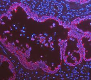 Cytokeratin 8/KRT8 Antibody