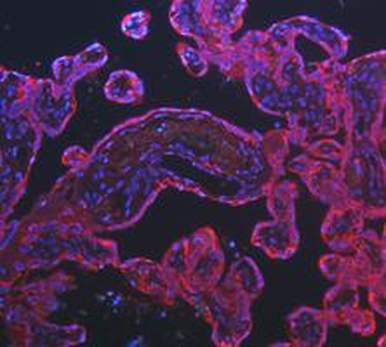 Cytokeratin 8/KRT8 Antibody