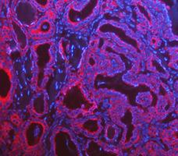 Cytokeratin 8/KRT8 Antibody