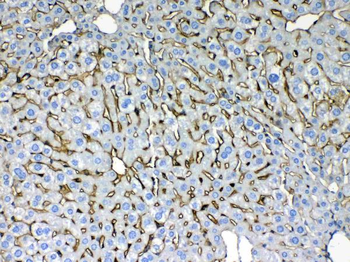 Cytokeratin 8/KRT8 Antibody