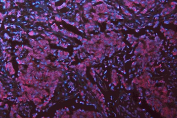 Musashi 1/Msi1 Antibody