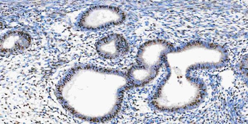 Musashi 1/Msi1 Antibody