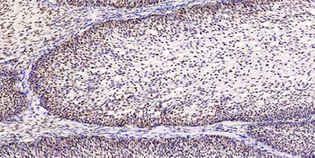 Musashi 1/Msi1 Antibody