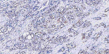 Musashi 1/Msi1 Antibody