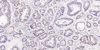 Musashi 1/Msi1 Antibody