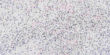 Musashi 1/Msi1 Antibody