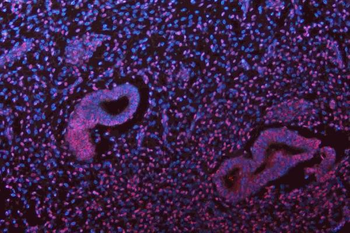 Musashi 1/Msi1 Antibody