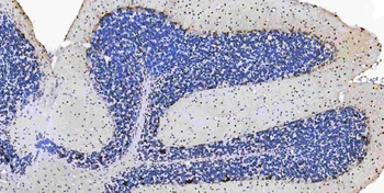 Musashi 1/Msi1 Antibody