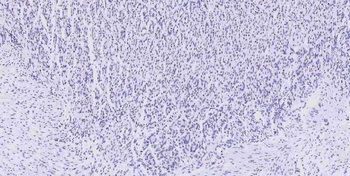 Musashi 1/Msi1 Antibody