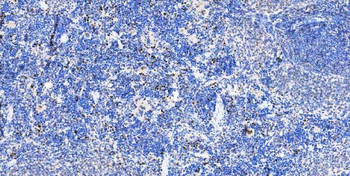 Musashi 1/Msi1 Antibody