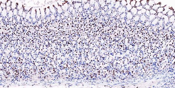 Musashi 1/Msi1 Antibody