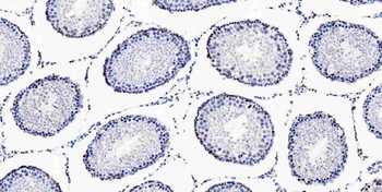 Musashi 1/Msi1 Antibody