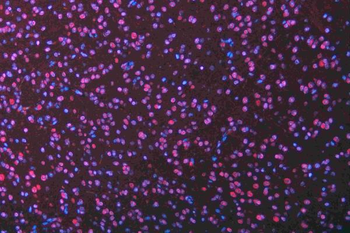 Musashi 1/Msi1 Antibody