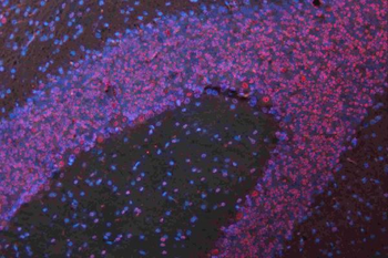 Musashi 1/Msi1 Antibody