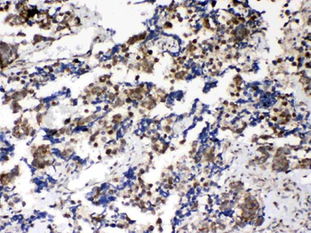 Musashi 1/Msi1 Antibody