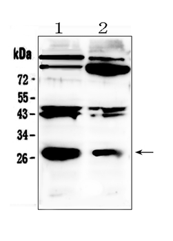 PDGF beta/PDGFB Antibody