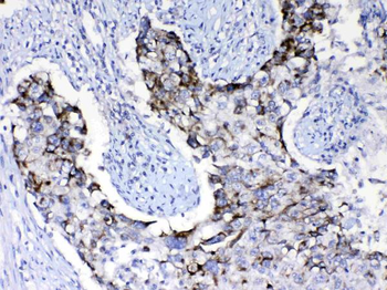 PI3 Kinase p110 beta/PIK3CB Rabbit Polyclonal Antibody