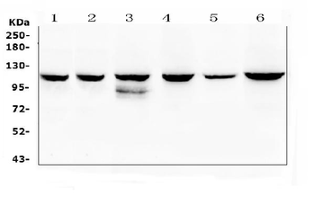 PI3 Kinase p110 beta/PIK3CB Rabbit Polyclonal Antibody