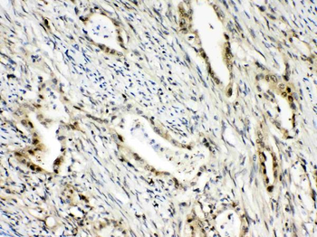 RanBP1 Rabbit Polyclonal Antibody