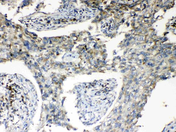 RPS6 Rabbit Polyclonal Antibody