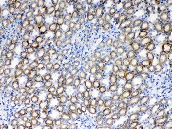 RPS6 Rabbit Polyclonal Antibody