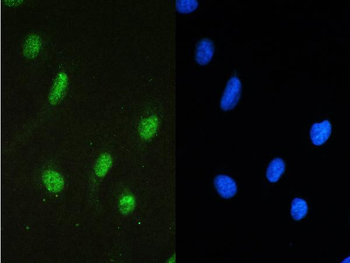 STAT1 Rabbit Polyclonal Antibody