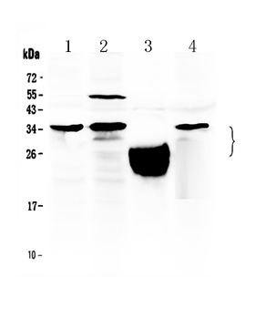 TFPI2 Rabbit Polyclonal Antibody