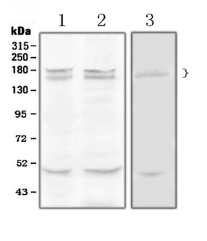 Thrombospondin/THBS1 Rabbit Polyclonal Antibody