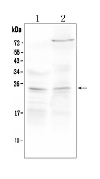 TIMP3 Rabbit Polyclonal Antibody