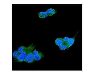 TIMP4 Rabbit Polyclonal Antibody