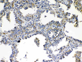 TIMP4 Rabbit Polyclonal Antibody