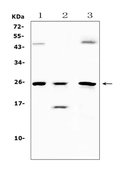 TIMP4 Rabbit Polyclonal Antibody