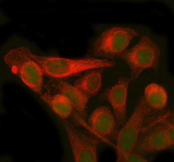 PMM2 Rabbit Polyclonal Antibody
