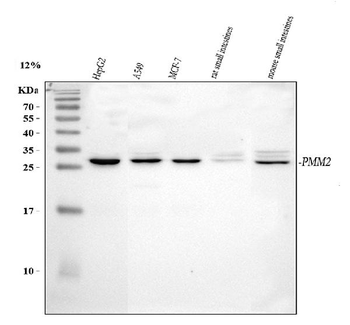 PMM2 Rabbit Polyclonal Antibody