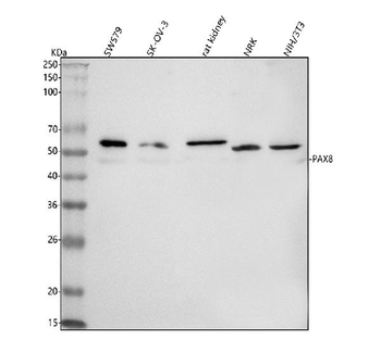 PAX8 Rabbit Polyclonal Antibody