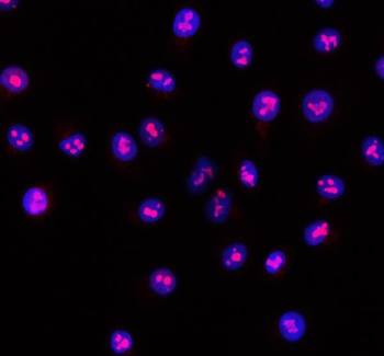 RSL24D1 Rabbit Polyclonal Antibody