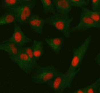 ORC2 Rabbit Polyclonal Antibody