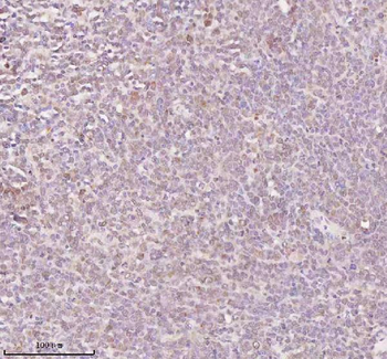 ORC2 Rabbit Polyclonal Antibody