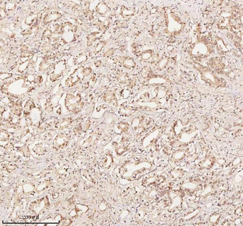 ORC2 Rabbit Polyclonal Antibody